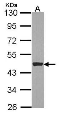 Western Blot: Cytokeratin 15 Antibody [NBP2-16088] - Sample (30 ug of whole cell lysate) A: NT2D1 10% SDS PAGE gel, diluted at 1:1000.