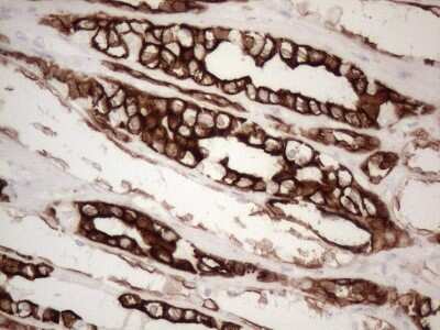 Immunohistochemistry: Cytokeratin 16 Antibody (2H8) [NBP2-45538] - Analysis of Human Kidney tissue. (Heat-induced epitope retrieval by 1mM EDTA in 10mM Tris buffer (pH8.5) at 120C for 3 min)