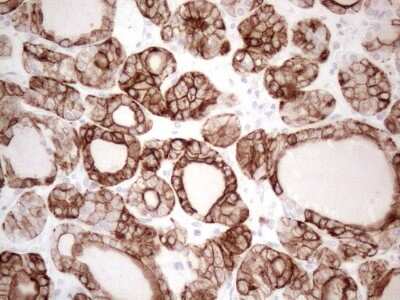 Immunohistochemistry: Cytokeratin 16 Antibody (2H8) [NBP2-45538] - Analysis of Human thyroid tissue. (Heat-induced epitope retrieval by 1mM EDTA in 10mM Tris buffer (pH8.5) at 120C for 3 min)