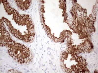 Immunohistochemistry: Cytokeratin 16 Antibody (2H8) [NBP2-45538] - Analysis of Human prostate tissue. (Heat-induced epitope retrieval by 1mM EDTA in 10mM Tris buffer (pH8.5) at 120C for 3 min)