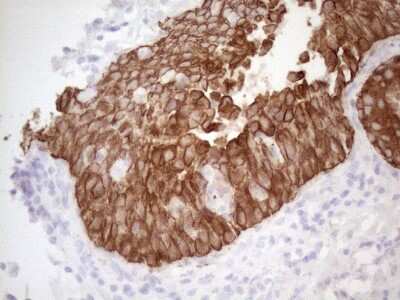 Immunohistochemistry: Cytokeratin 16 Antibody (2H8) [NBP2-45538] - Analysis of Human bladder tissue. (Heat-induced epitope retrieval by 1mM EDTA in 10mM Tris buffer (pH8.5) at 120C for 3 min)