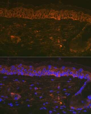 Immunohistochemistry: Cytokeratin 16 Antibody (8L6R4) [NBP3-16678] - Immunofluorescence analysis of Mouse tail and ear using Cytokeratin 16 Rabbit mAb (NBP3-16678) at dilution of 1:100 (40x lens). Blue: DAPI for nuclear staining.