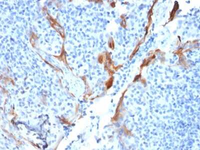 Immunohistochemistry-Paraffin: Cytokeratin 16 Antibody (KRT16/1714) - Azide and BSA Free [NBP3-08691] - Formalin-fixed, paraffin-embedded human Tonsil stained with Cytokeratin 16 Mouse Monoclonal Antibody (KRT16/1714).