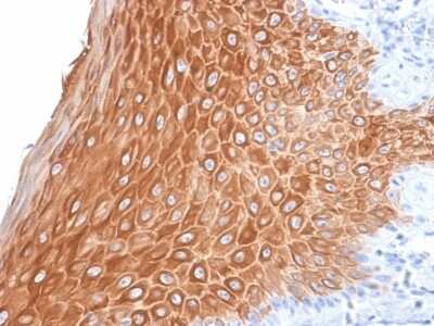 Immunohistochemistry-Paraffin: Cytokeratin 16 Antibody (KRT16/2043R) - Azide and BSA Free [NBP3-08540] - Formalin-fixed, paraffin-embedded human Skin stained with Cytokeratin 16 Rabbit Recombinant Monoclonal Antibody (KRT16/2043R).