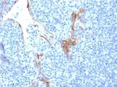 Immunohistochemistry-Paraffin: Cytokeratin 16 Antibody (LL025) - Azide and BSA Free [NBP3-08684] - Formalin-fixed, paraffin-embedded human Tonsil stained with Cytokeratin 16 Mouse Monoclonal Antibody (LL025).