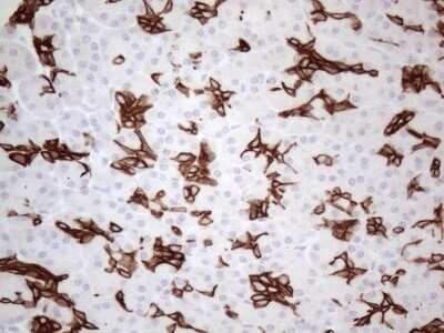 Immunohistochemistry: Cytokeratin 16 Antibody (OTI2H8) - Azide and BSA Free [NBP2-71085] - Analysis of Human pancreas tissue. (Heat-induced epitope retrieval by 1mM EDTA in 10mM Tris buffer (pH8.5) at 120C for 3 min)