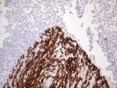 Immunohistochemistry: Cytokeratin 16 Antibody (OTI2H8) - Azide and BSA Free [NBP2-71085] - Analysis of Human tonsil tissue. (Heat-induced epitope retrieval by 1mM EDTA in 10mM Tris buffer (pH8.5) at 120C for 3 min)