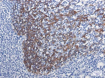 Immunohistochemistry-Paraffin: Cytokeratin 16 Antibody (S02-5F8) [NBP3-19530] - Immunohistochemistry of Cytokeratin 16 in paraffin-embedded Human tonsil using NBP3-19530 at dilution 1/100