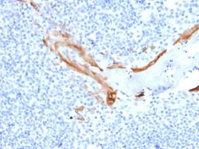 Immunohistochemistry-Paraffin: Cytokeratin 16 Antibody (SPM264) - Azide and BSA Free [NBP3-08692] - Formalin-fixed, paraffin-embedded human Tonsil stained with Cytokeratin 16 Mouse Monoclonal Antibody (SPM264).