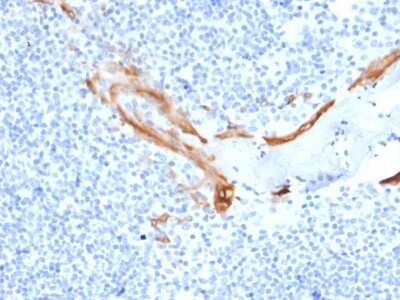 Immunohistochemistry-Paraffin: Cytokeratin 16 Antibody (SPM264) [NBP3-07649] - Formalin-fixed, paraffin-embedded human Tonsil stained with Cytokeratin 16 Mouse Monoclonal Antibody (SPM264).