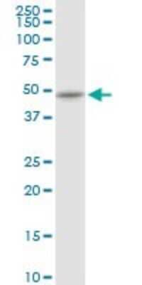 Western Blot: Cytokeratin 16 Antibody [H00003868-D01P] - Analysis of KRT16 expression in HeLa.