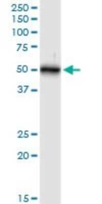 Western Blot: Cytokeratin 16 Antibody [H00003868-D01P] - Analysis of KRT16 expression in mouse liver.