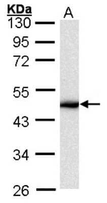 Western Blot: Cytokeratin 16 Antibody [NBP1-32709] - Sample (30 ug of whole cell lysate)A: HeLa10% SDS PAGE, antibody diluted at 1:1000.