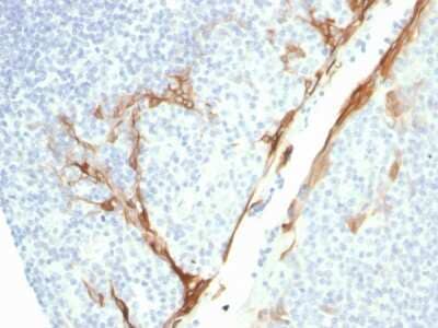 Immunohistochemistry-Paraffin: Cytokeratin 16 Antibody (rKRT16/1714) - Azide and BSA Free [NBP3-08539] - Formalin-fixed, paraffin-embedded human Tonsil stained with Cytokeratin 16 Mouse Recombinant Monoclonal Antibody (rKRT16/1714).