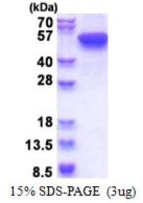 SDS-PAGE Recombinant Human Cytokeratin 16 His Protein