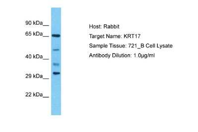 Western Blot: Cytokeratin 17/36 Antibody [NBP2-83994] - Host: Rabbit. Target Name: KRT17. Sample Type: 721_B Whole Cell lysates. Antibody Dilution: 1.0ug/ml