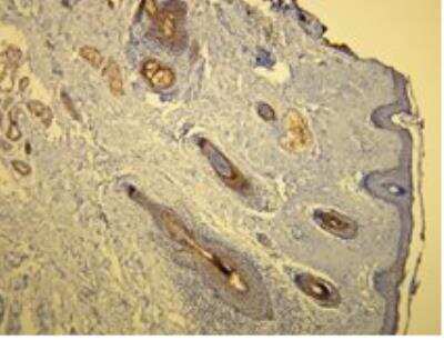 Immunohistochemistry-Paraffin: Cytokeratin 17 Antibody (V21-R) [NBP1-79071] - CK17 expressed in the skin-adnexal epithelial cells. Formalin fixed, paraffin embedded human tissue (4 um section) stained with anti-Cytokeratin 17 monospecific clonal antibody.