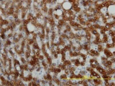 Immunohistochemistry-Paraffin: Cytokeratin 18 Antibody (2F8) [H00003875-M01] - Analysis of monoclonal antibody to KRT18 on formalin-fixed paraffin-embedded human liver tissue. Antibody concentration 3 ug/ml.