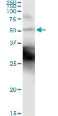 Immunoprecipitation: Cytokeratin 18 Antibody (2F8) [H00003875-M01] - Analysis of KRT18 transfected lysate using anti-KRT18 monoclonal antibody and Protein A Magnetic Bead, and immunoblotted with KRT18 MaxPab rabbit polyclonal antibody.