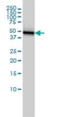 Western Blot: Cytokeratin 18 Antibody (2F8) [H00003875-M01] - KRT18 monoclonal antibody (M01), clone 2F8 Analysis of KRT18 expression in HeLa.