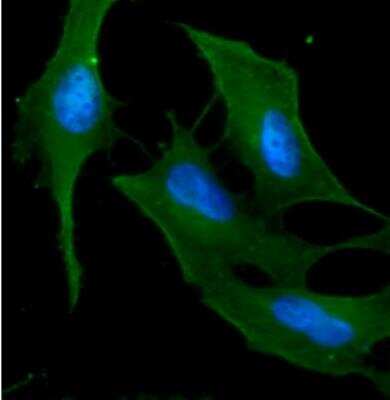 Immunocytochemistry/Immunofluorescence: Cytokeratin 18 Antibody (2G3) [NBP1-74034] - ICC/IF analysis of KRT18 in HeLa cells line, stained with DAPI (Blue) for nucleus staining and monoclonal anti-human KRT18 antibody (1:100) with goat anti-mouse IgG-Alexa fluor 488 conjugate (Green).