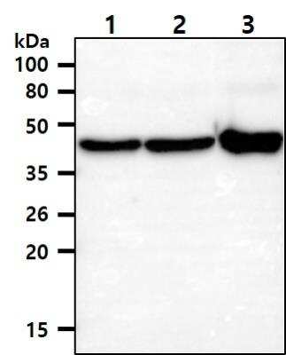 Western Blot: Cytokeratin 18 Antibody (2G3) [NBP1-74034] - The cell lysates (40ug) were resolved by SDS-PAGE, transferred to PVDF membrane and probed with anti-human Cytokeratin 18 antibody (1:1000). Proteins were visualized using a goat anti-mouse secondary antibody conjugated to HRP and an ECL detection system.Lane 1.: HeLa cell lysateLane 2.: A549 cell lysateLane 3.: MCF7 cell lysate