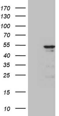Western Blot: Cytokeratin 18 Antibody (3D1) [NBP2-45554] - Analysis of HEK293T cells were transfected with the pCMV6-ENTRY control (Left lane) or pCMV6-ENTRY Cytokeratin 18.