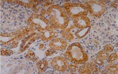 Immunohistochemistry: Cytokeratin 18 Antibody (C-04) [Biotin] [NB500-640] -  Immunohistochemistry staining of human kidney (paraffin-embedded sections) with anti-cytokeratin 18 (C-04).