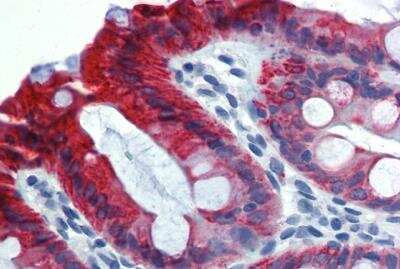 Immunohistochemistry: Cytokeratin 18 Antibody (C-04) [Biotin] [NB500-640] -  Immunohistochemistry staining of human colon (paraffin-embedded sections) with anti-cytokeratin 18 (C-04).