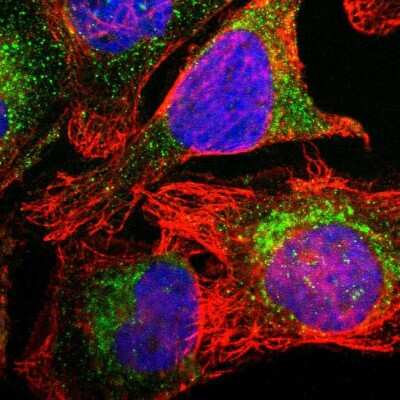 <b>Orthogonal Strategies Validation. </b>Immunocytochemistry/Immunofluorescence: Cytokeratin 18 Antibody [NBP1-90353] - Staining of human cell line U-2 OS shows localization to cytosol. Antibody staining is shown in green.
