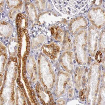 Immunohistochemistry-Paraffin: Cytokeratin 18 Antibody [NBP1-90353] - Staining of human kidney shows moderate cytoplasmic and membrane positivity in cells in tubules.
