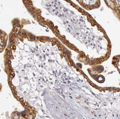 Immunohistochemistry-Paraffin: Cytokeratin 18 Antibody [NBP1-90353] - Staining of human placenta shows moderate cytoplasmic and membrane positivity in trophoblastic cells.