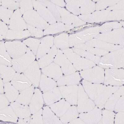 Immunohistochemistry-Paraffin: Cytokeratin 18 Antibody [NBP1-90353] - Staining of human skeletal muscle shows no cytoplasmic positivity in myocytes as expected.