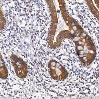 Immunohistochemistry-Paraffin: Cytokeratin 18 Antibody [NBP1-90353] - Staining of human small intestine shows moderate cytoplasmic and membrane positivity in glandular cells.