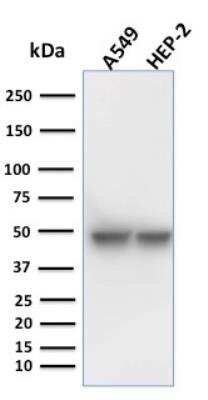 Western Blot: Cytokeratin 18 Antibody (KRT18/1190) - Azide and BSA Free [NBP2-47984] - A549 and HEP-2 cell lysate using Cytokeratin 18 Mouse Monoclonal Antibody (KRT18/1190).