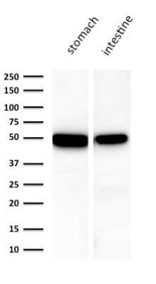 Western Blot: Cytokeratin 18 Antibody (KRT18/1190) [NBP2-44942] - Western Blot Analysis of human A) Stomach B) Intestine lysate using Cytokeratin 18 Antibody (KRT18/1190).