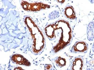 Immunohistochemistry-Paraffin: Cytokeratin 18 Antibody (KRT18/834) - IHC-Prediluted [NBP2-48056] - Human Skin stained with Cytokeratin 18 Monoclonal Antibody (KRT18/834).