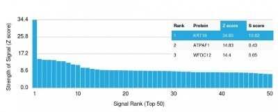 Protein Array: Cytokeratin 18 Antibody (KRT18/835) - Azide and BSA Free [NBP2-47986] - Analysis of Protein Array containing >19,000 full-length human proteins using Cytokeratin 18 Antibody (KRT18/835) Z- and S- Score: The Z-score represents the strength of a signal that a monoclonal antibody (MAb) (in combination with a fluorescently-tagged anti-IgG secondary antibody) produces when binding to a particular protein on the HuProt(TM) array. Z-scores are described in units of standard deviations (SD's) above the mean value of all signals generated on that array. If targets on HuProt(TM) are arranged in descending order of the Z-score, the S-score is the difference (also in units of SD's) between the Z-score. S-score therefore represents the relative target specificity of a MAb to its intended target. A MAb is considered to specific to its intended target, if the MAb has an S-score of at least 2.5.