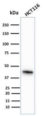 Western Blot: Cytokeratin 18 Antibody (KRT18/836) [NBP2-44950] - Western Blot Analysis of human HCT116 cell lysate using Cytokeratin 18 Antibody (KRT18/836)