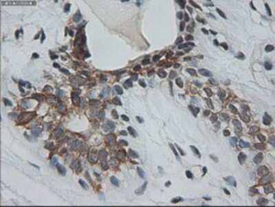 Immunohistochemistry: Cytokeratin 18 Antibody (OTI1E1) - Azide and BSA Free [NBP2-71086] - Staining of paraffin-embedded Human breast tissue using anti-KRT18 mouse monoclonal antibody.