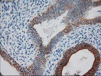 Immunohistochemistry: Cytokeratin 18 Antibody (OTI1E1) - Azide and BSA Free [NBP2-71086] - Staining of paraffin-embedded Human endometrium tissue using anti-KRT18 mouse monoclonal antibody.