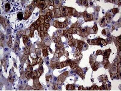 Immunohistochemistry: Cytokeratin 18 Antibody (OTI1E1) - Azide and BSA Free [NBP2-71086] - Staining of paraffin-embedded Human liver tissue within the normal limits. Heat-induced epitope retrieval by 1mM EDTA in 10mM Tris buffer (pH8.0) at 120C for 3 min, (1:6000).