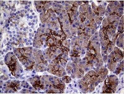 Immunohistochemistry: Cytokeratin 18 Antibody (OTI1E1) - Azide and BSA Free [NBP2-71086] - Staining of paraffin-embedded Human pancreas tissue within the normal limits. Heat-induced epitope retrieval by 10mM citric buffer, pH6.0, 100C for 10min.