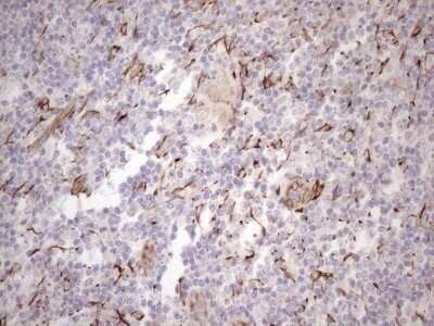 Immunohistochemistry: Cytokeratin 18 Antibody (OTI3D1) - Azide and BSA Free [NBP2-71089] - Analysis of Human lymph node tissue. (Heat-induced epitope retrieval by 1mM EDTA in 10mM Tris buffer (pH8.5) at 120C for 3 min)