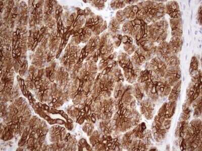 Immunohistochemistry: Cytokeratin 18 Antibody (OTI3D1) - Azide and BSA Free [NBP2-71089] - Analysis of Human pancreas tissue. (Heat-induced epitope retrieval by 1mM EDTA in 10mM Tris buffer (pH8.5) at 120C for 3 min)