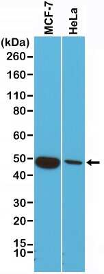 Western Blot: Cytokeratin 18 Antibody (RM279) [NBP2-61519] - Western Blot of MCF-7 and HeLa cells lysates using NBP2-61519.