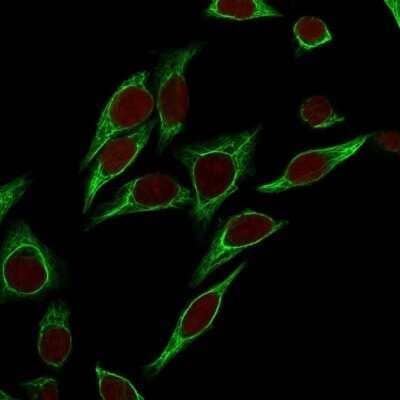Immunocytochemistry/Immunofluorescence: Cytokeratin 18 Antibody (SPM265) - Azide and BSA Free [NBP2-34404] - Confocal Immunofluorescence of HeLa cells Cytokeratin 18 Antibody (SPM265). labeled with CF488 (Green); Red Dot is used to label the nuclei.