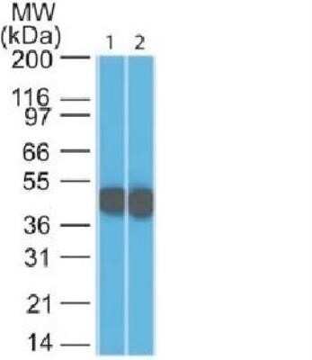 Western Blot: Cytokeratin 18 Antibody (SPM265) - Azide and BSA Free [NBP2-34404] - Western Blot 1) HeLa and 2) A431 Lysate using Cytokeratin 18 Monoclonal Antibody (SPM265)