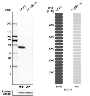 Western Blot: Cytokeratin 18 Antibody [NBP1-90353] - Analysis in human cell lines MCF-7 and SK-MEL-30 using anti-KRT18 antibody. Corresponding KRT18 RNA-seq data are presented for the same cell lines. Loading control: anti-PFN1.