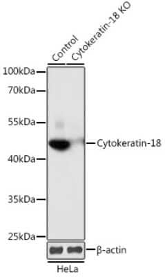 Western Blot: Cytokeratin 18 Antibody [NBP3-03416] - Analysis of extracts from normal (control) and Cytokeratin-18 knockout (KO) HeLa cells, using Cytokeratin 18 antibody at 1:1000 dilution. Secondary antibody: HRP Goat Anti-Rabbit IgG (H+L) at 1:10000 dilution. Lysates/proteins: 25ug per lane. Blocking buffer: 3% nonfat dry milk in TBST.
